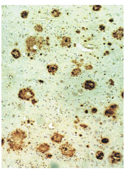 memorise literacy Plaque  brain