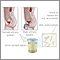 Uric acid test