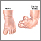 Club foot repair- series