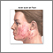 Skin smoothing surgery- series