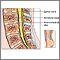 Lumbar spinal surgery- series