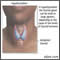 Hypothyroidism