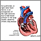 Cor pulmonale