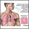 Tuberculosis of the lungs