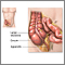 Appendectomy- series