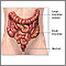 Colostomy- series