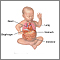 Diaphragmatic hernia repair- series
