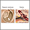 Eardrum repair- series