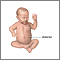 Omphalocele repair- series
