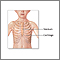 Pectus excavatum repair- series