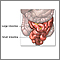 Small bowel resection- series