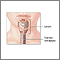 Tracheostomy- series