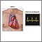 Electrocardiogram (ECG)