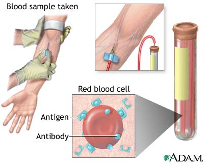 Antibody titer