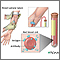 Antibody titer