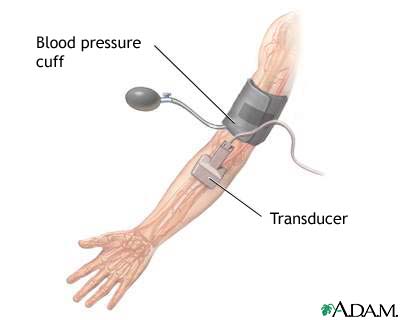 Duplex/doppler ultrasound test