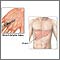 Liver function tests