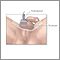 Tesitcular ultrasound