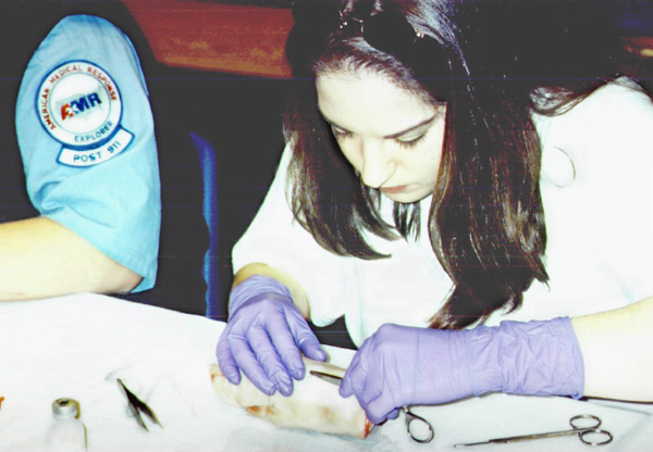 stitches 2