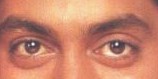 eye11.jpg (4034 bytes)