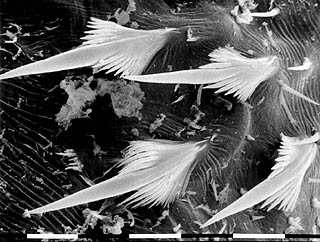 scales on the siphon of a mosquito larva