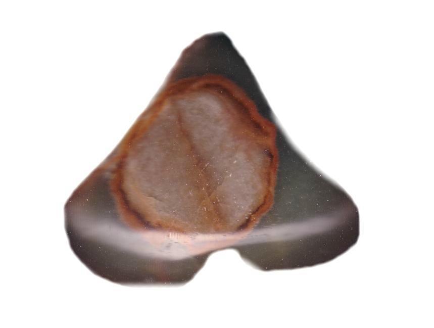 Onyx