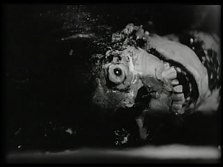cadaver