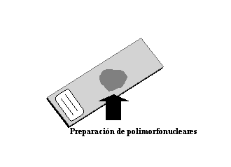 Preparacin de neutrfilos