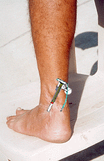 my leg with the fuse on