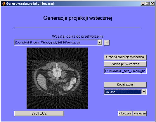 Tomography - back projection