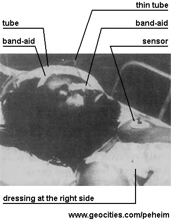 Abu-Jamal in a hospital bed