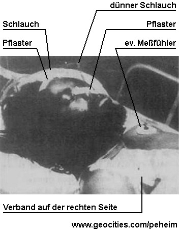 Abu-Jamal im Krankenbett