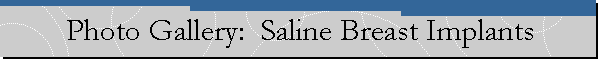 Photo Gallery:  Saline Breast Implants
