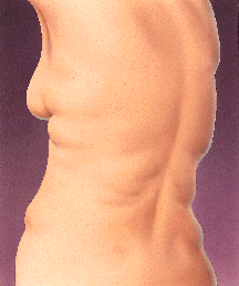 Person before surgery