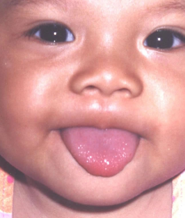 Show me your tongue