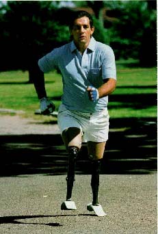 Prosthetic Legs
