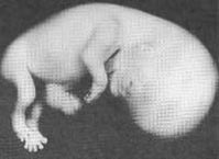 Photo of an embryo at 8 weeks