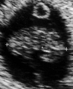 My Baby at 8 weeks