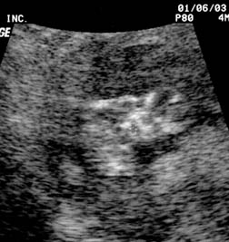 My Baby at 12 weeks