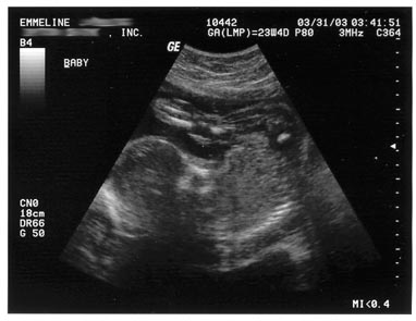 My Baby's whole body