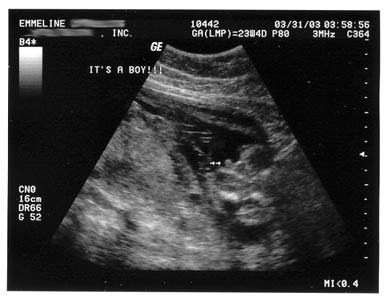 I'm a BOY!!!