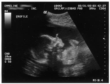 My Baby's Profile at 24 weeks