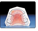Retainers