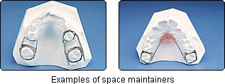 Space Maintainers