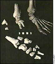 foot bones