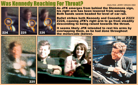 Reaching for Throat?