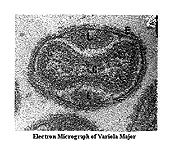 smallpox_picture_3