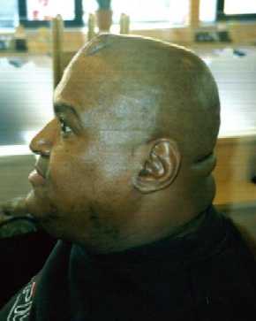 Abdullah's head