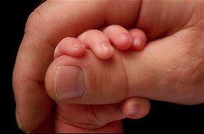 Prolife
