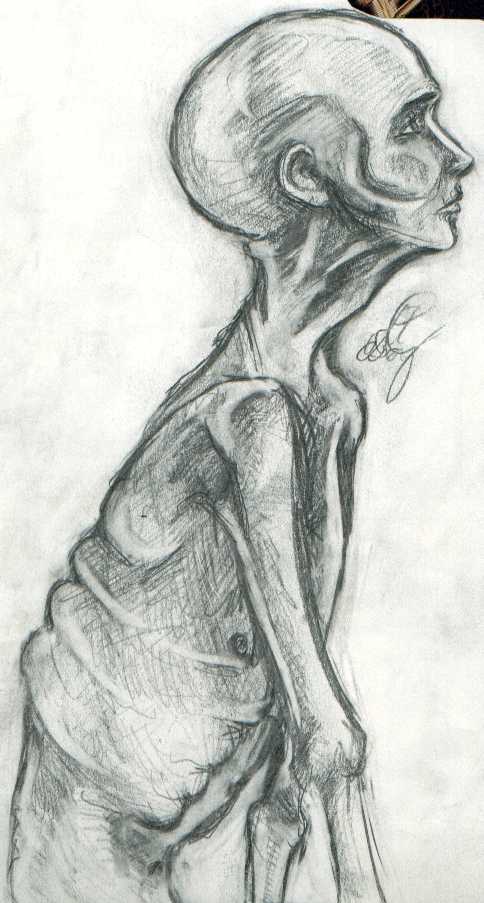 Skeletal Study